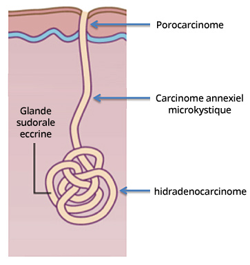 carcinome annexiel
